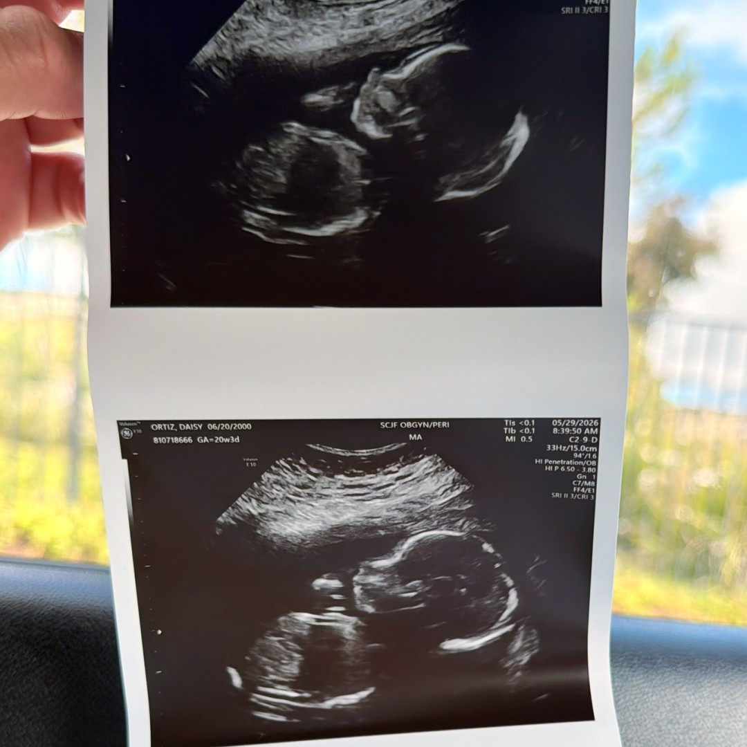 Photo shared by Daisy for their Babylist baby registry.