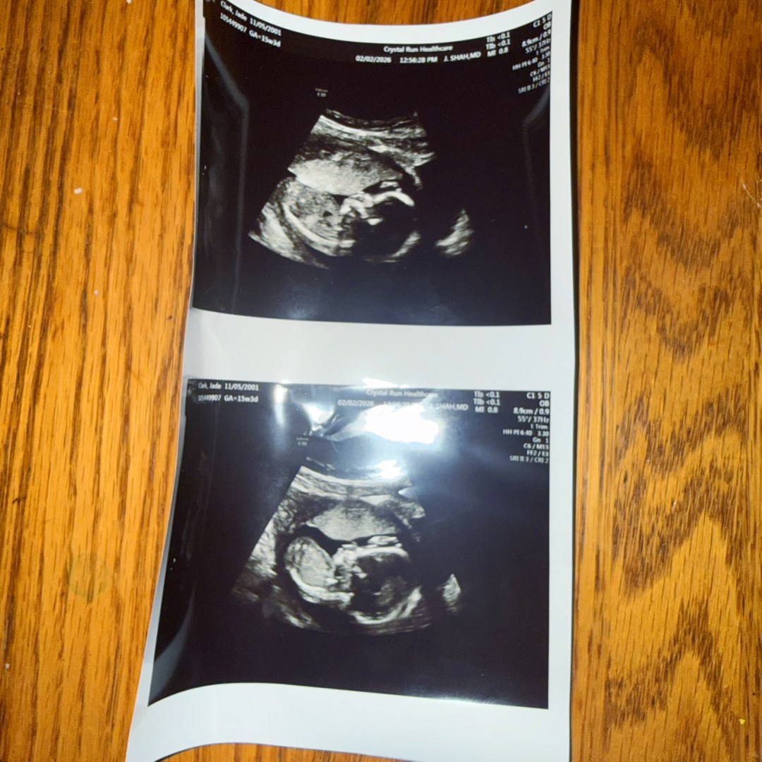 Photo shared by Jade for their Babylist baby registry.