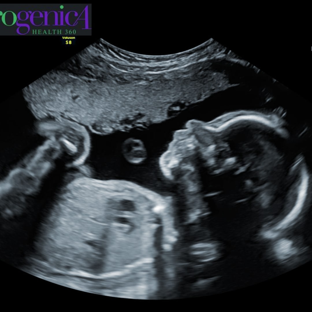 Photo shared by Ebonie for their Babylist baby registry.