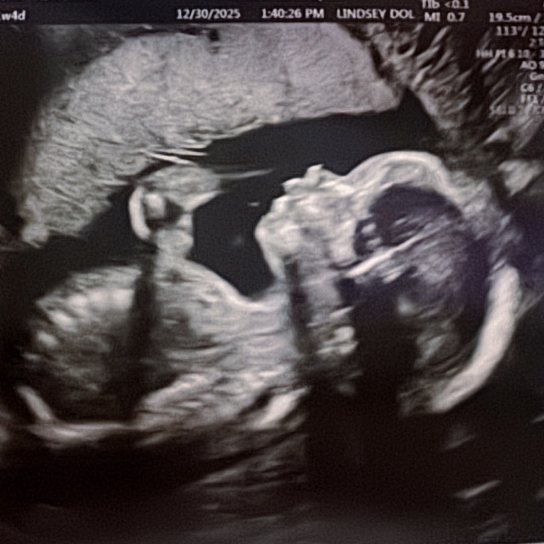 Photo shared by Samm for their Babylist baby registry.