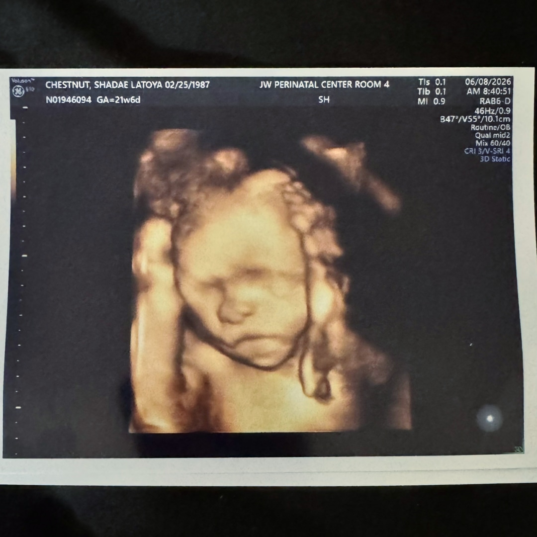 Photo shared by Shadae for their Babylist baby registry.