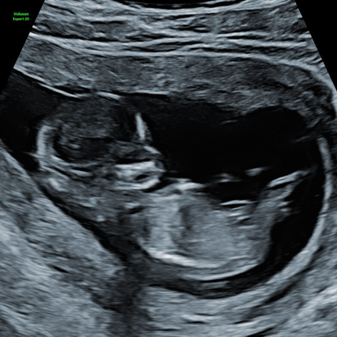 Photo shared by Jayme for their Babylist baby registry.