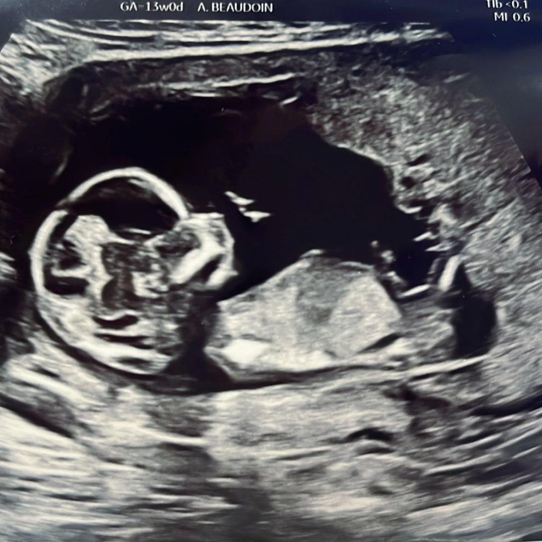 Photo shared by Cristina for their Babylist baby registry.