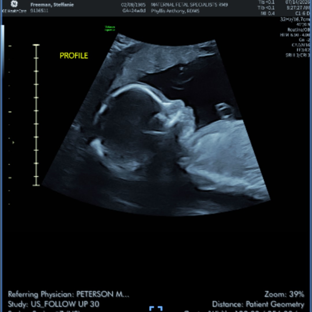 Photo shared by Steffanie Beth for their Babylist baby registry.