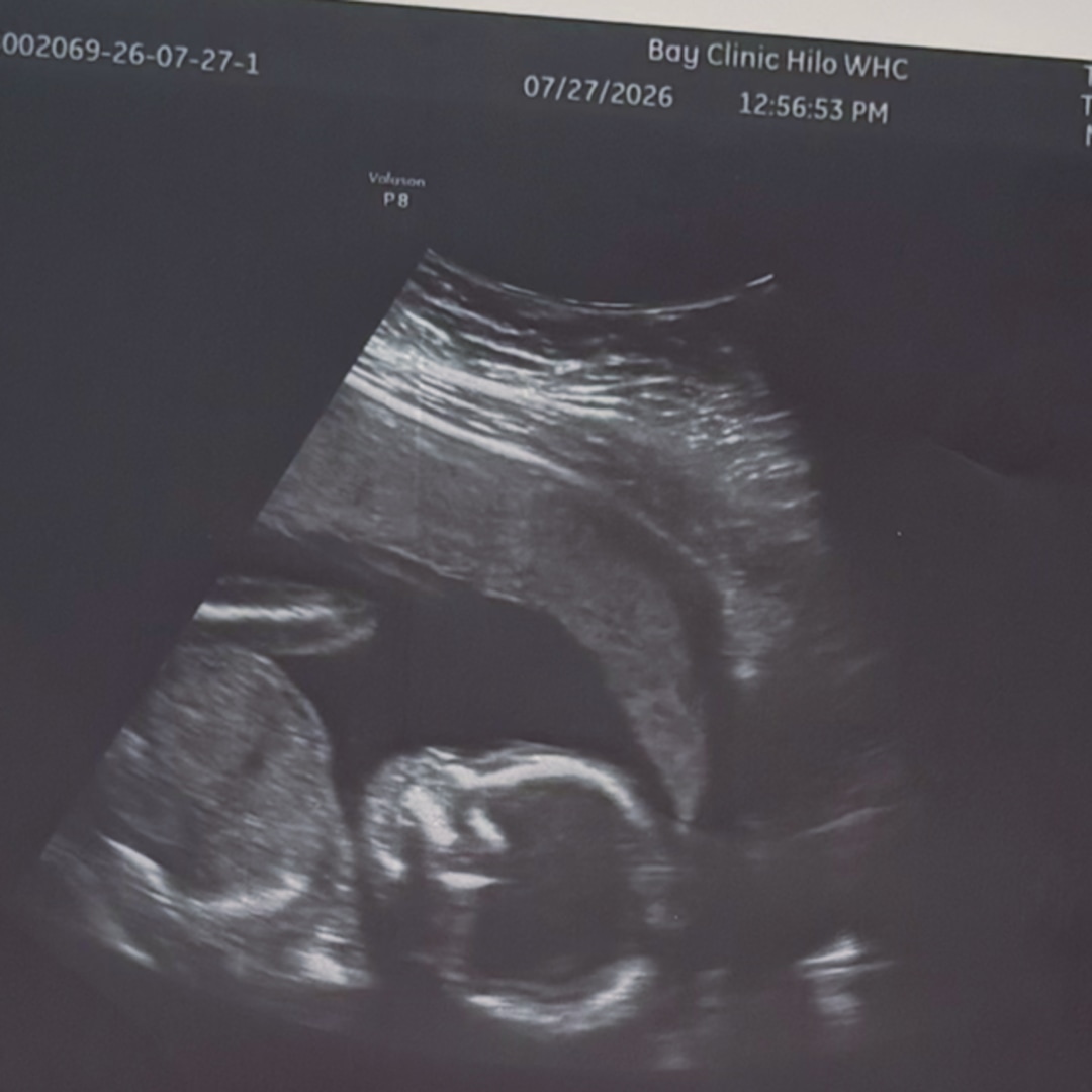 Photo shared by Naia for their Babylist baby registry.