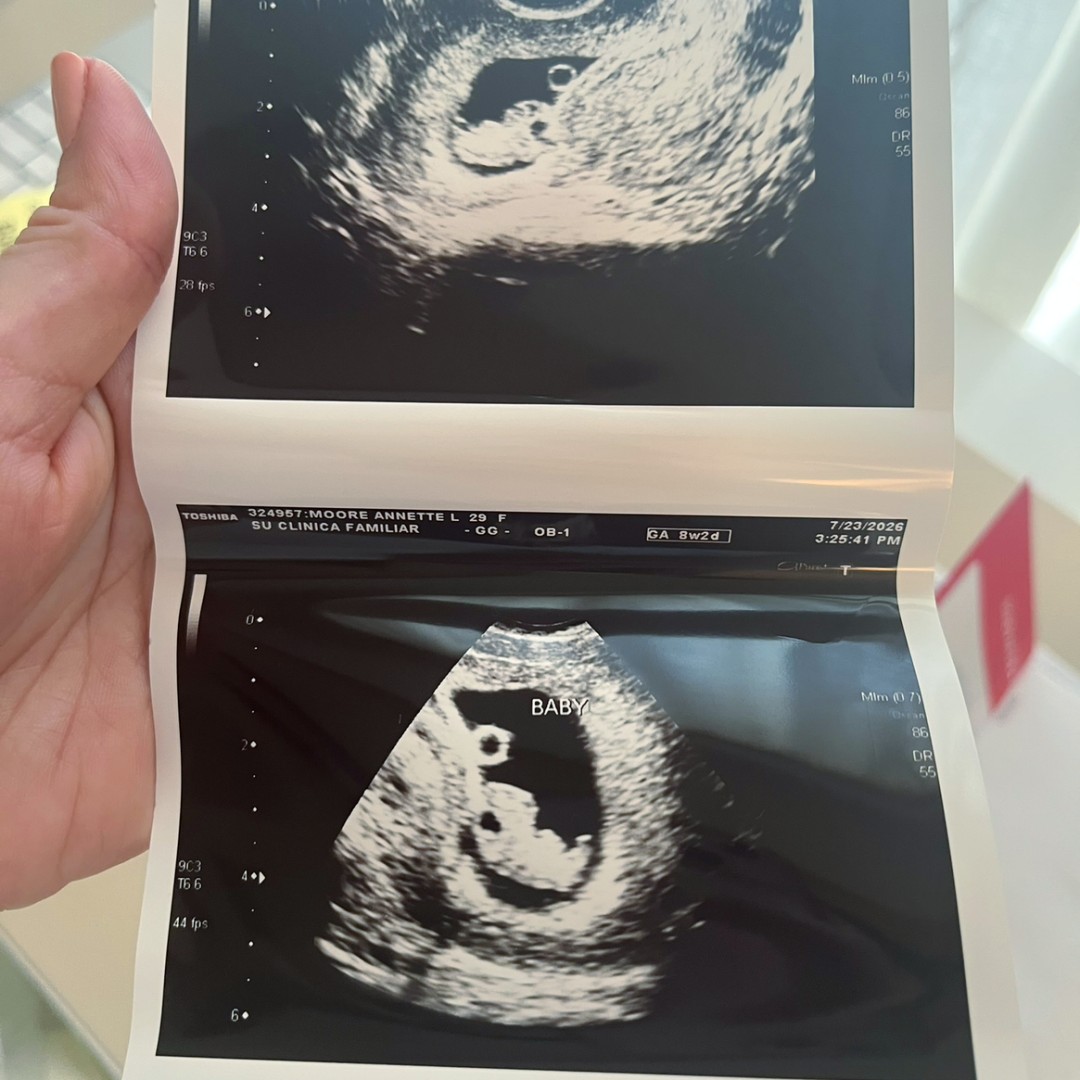 Photo shared by Annette for their Babylist baby registry.