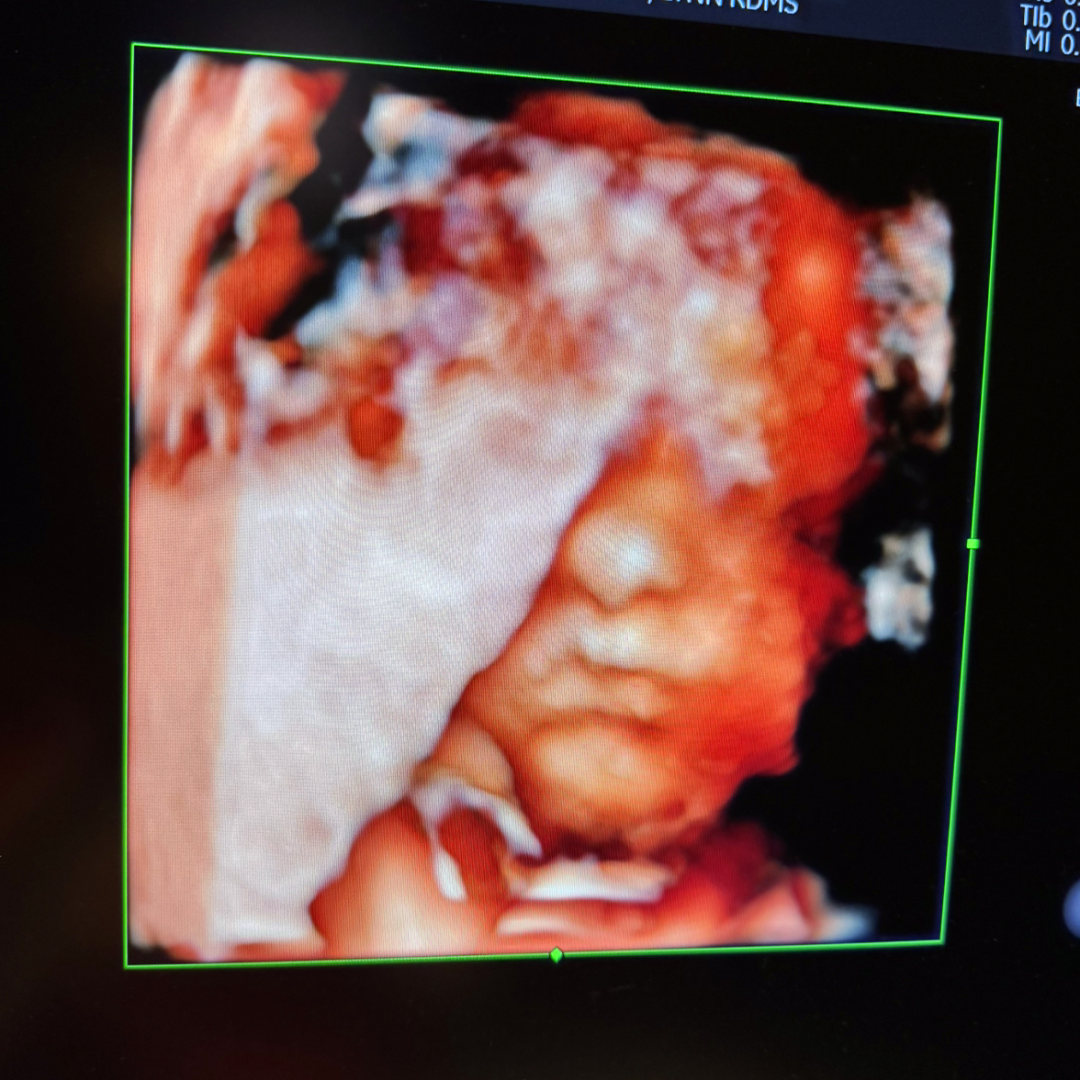 Photo shared by Jessie for their Babylist baby registry.