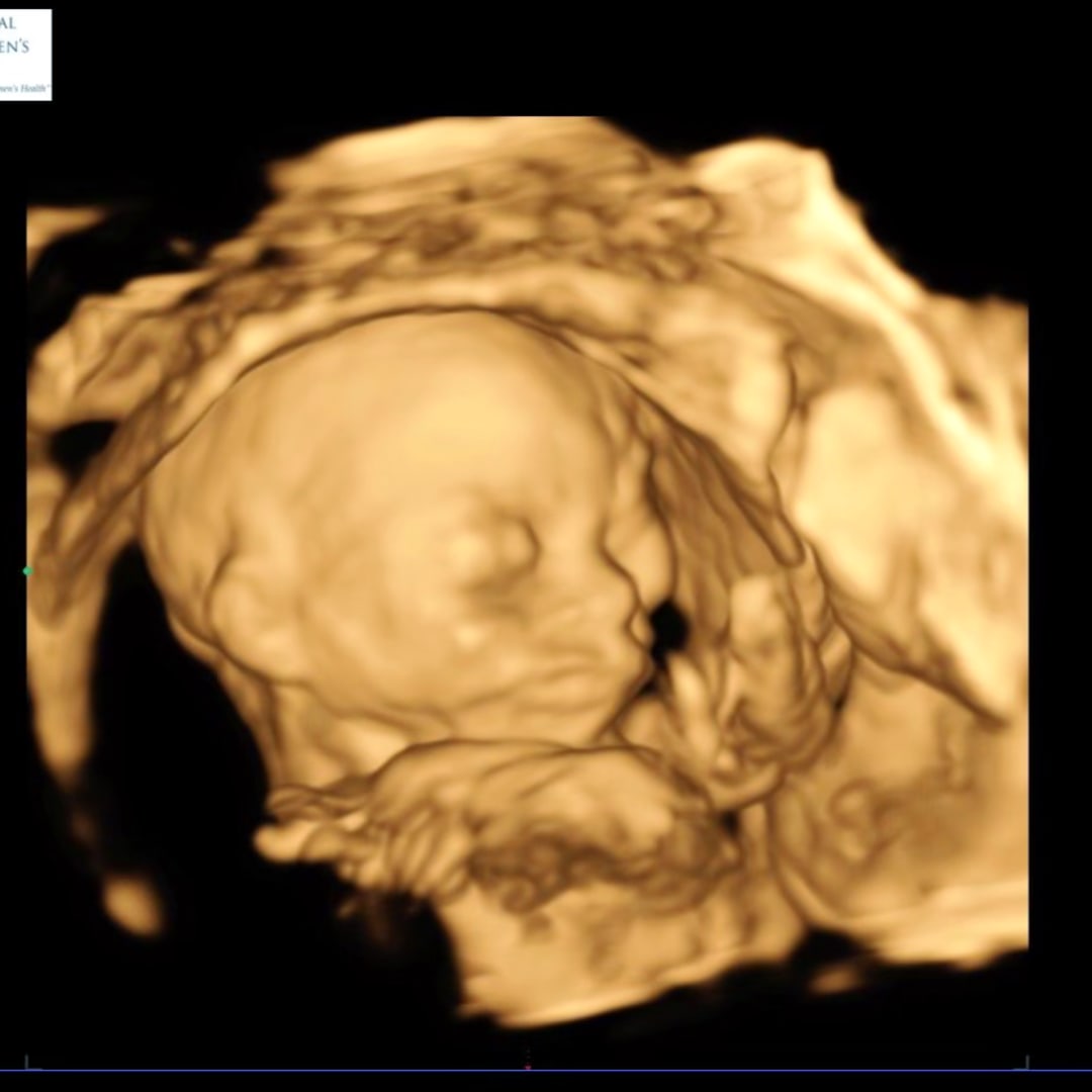 Photo shared by Promise for their Babylist baby registry.