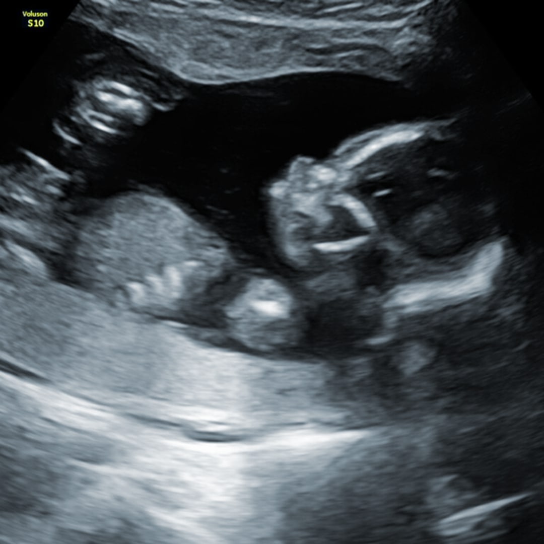 Photo shared by Lizzy for their Babylist baby registry.