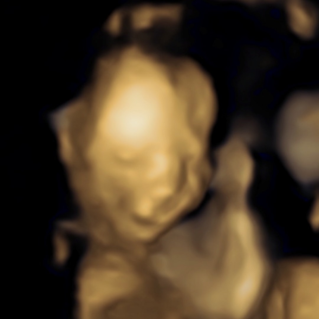 Photo shared by Peyton for their Babylist baby registry.