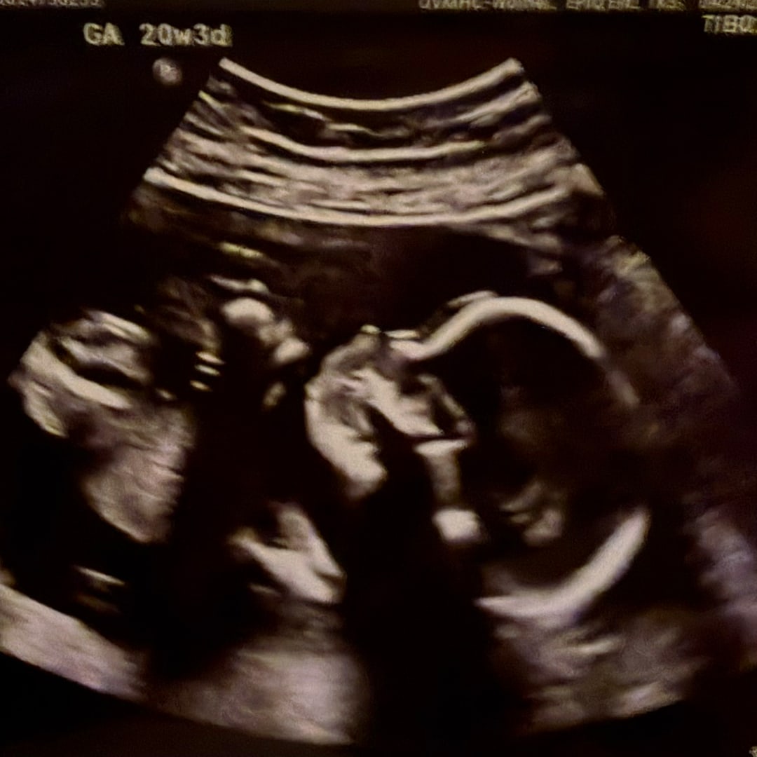 Photo shared by Heather for their Babylist baby registry.