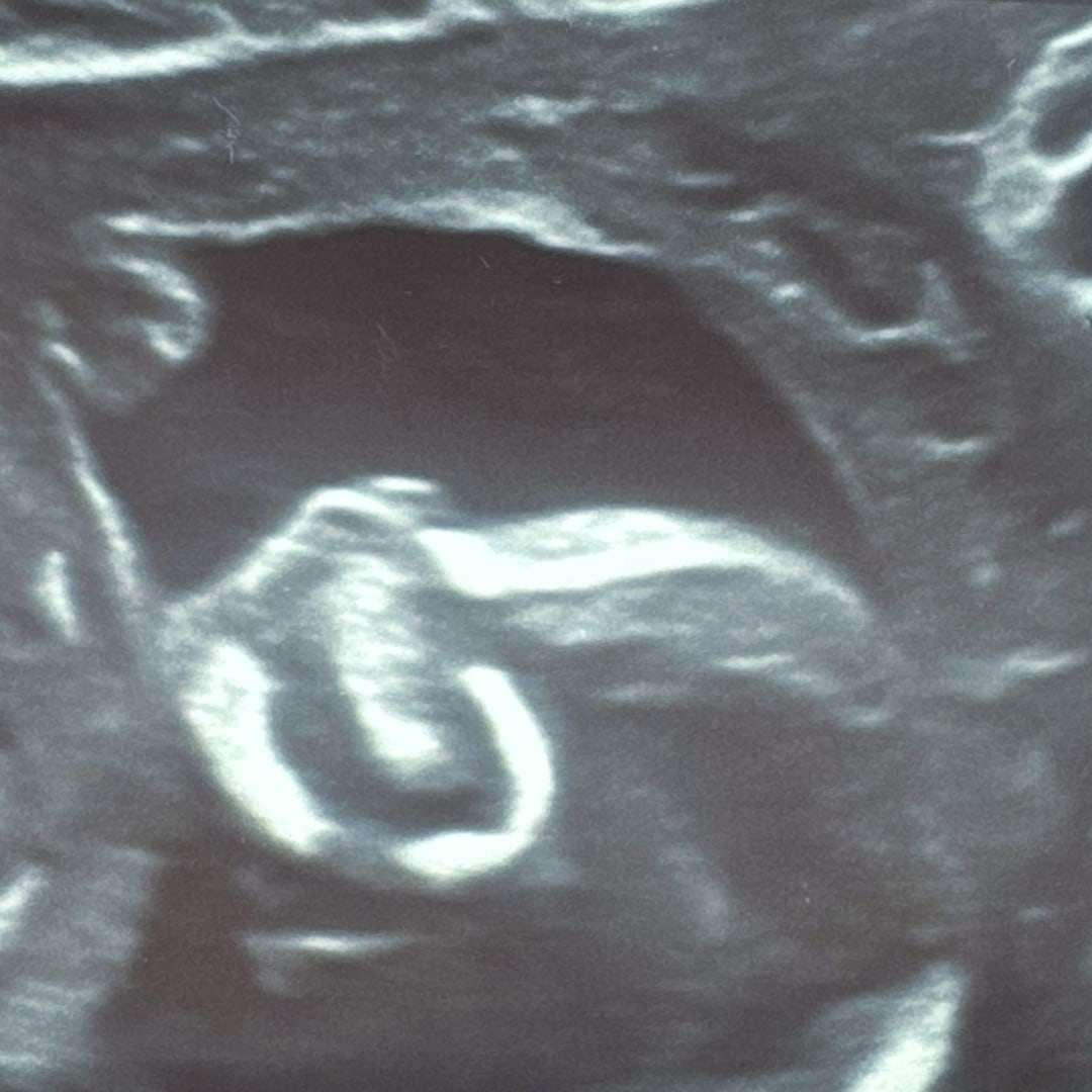 Photo shared by Anasha for their Babylist baby registry.