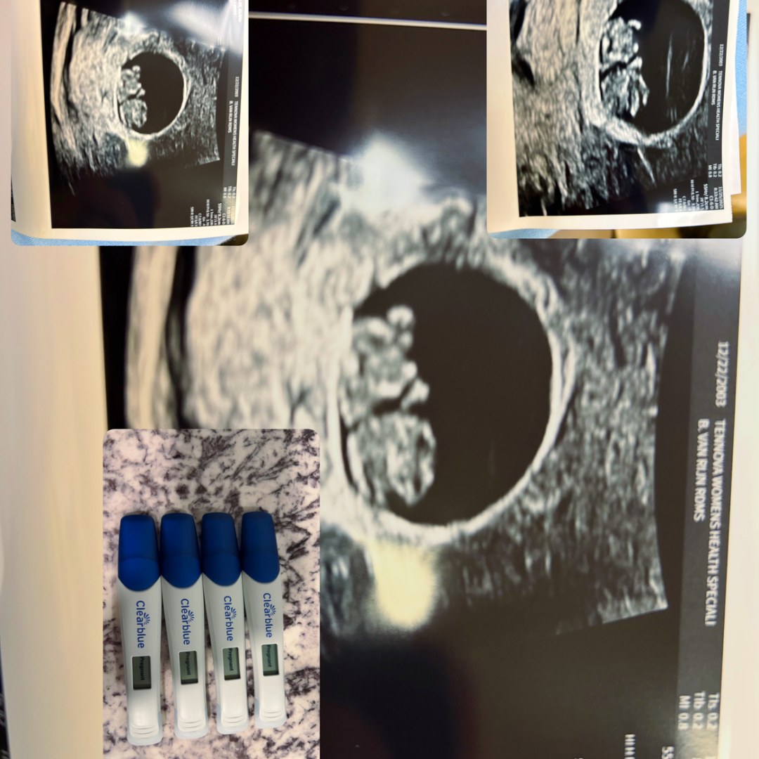 Photo shared by Olivia for their Babylist baby registry.