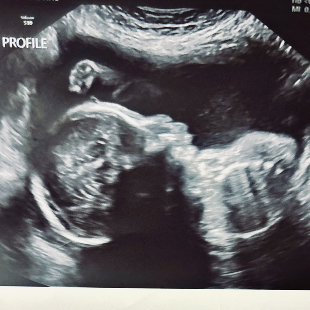 Photo shared by Kimberly for their Babylist baby registry.