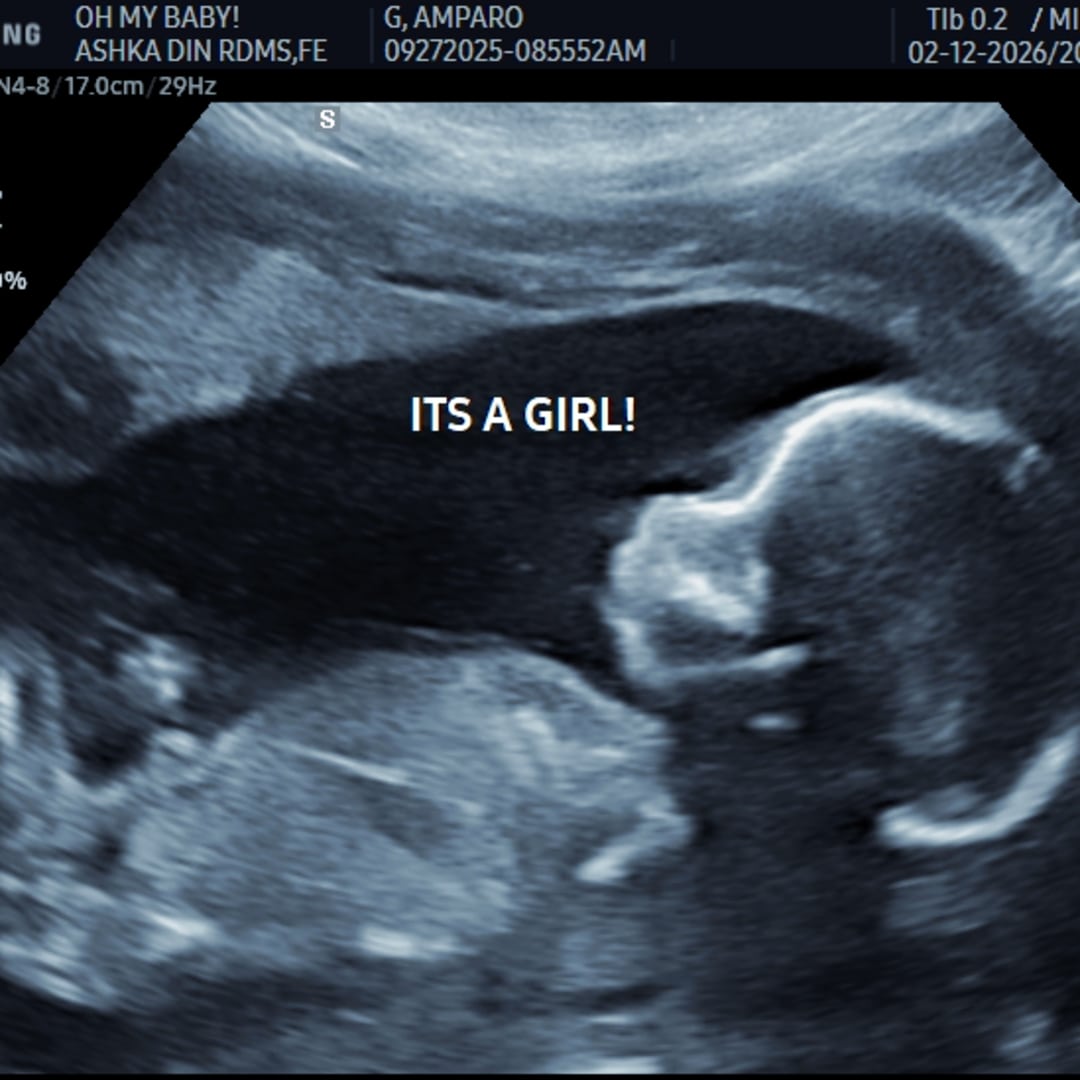 Photo shared by Amparo for their Babylist baby registry.