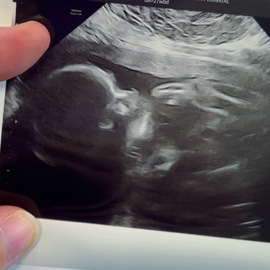 Photo shared by Lanna for their Babylist baby registry.