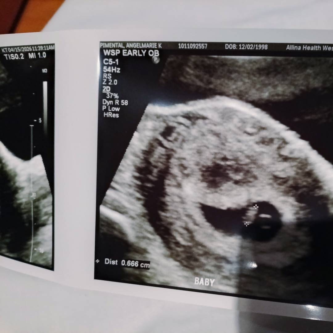 Photo shared by Angelmarie for their Babylist baby registry.