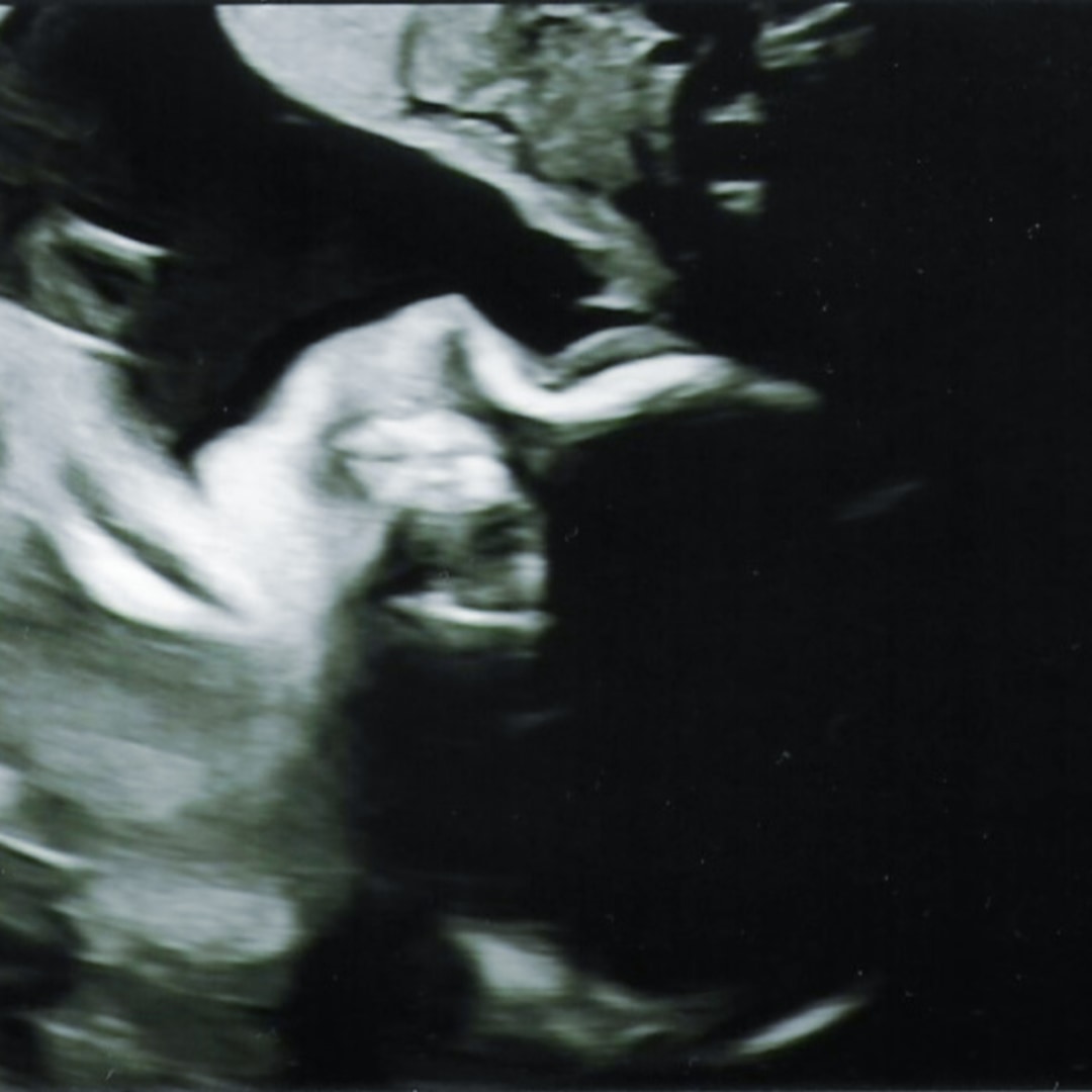 Photo shared by Melissa for their Babylist baby registry.