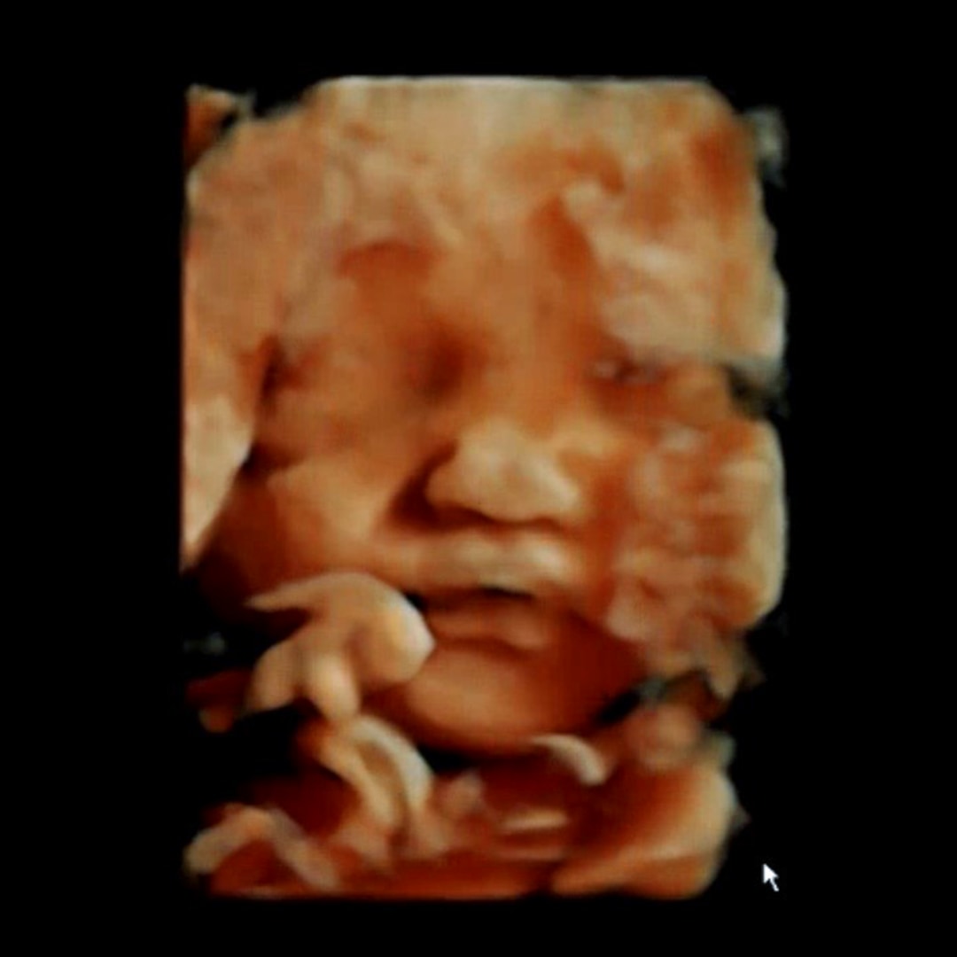 Photo shared by Chea for their Babylist baby registry.