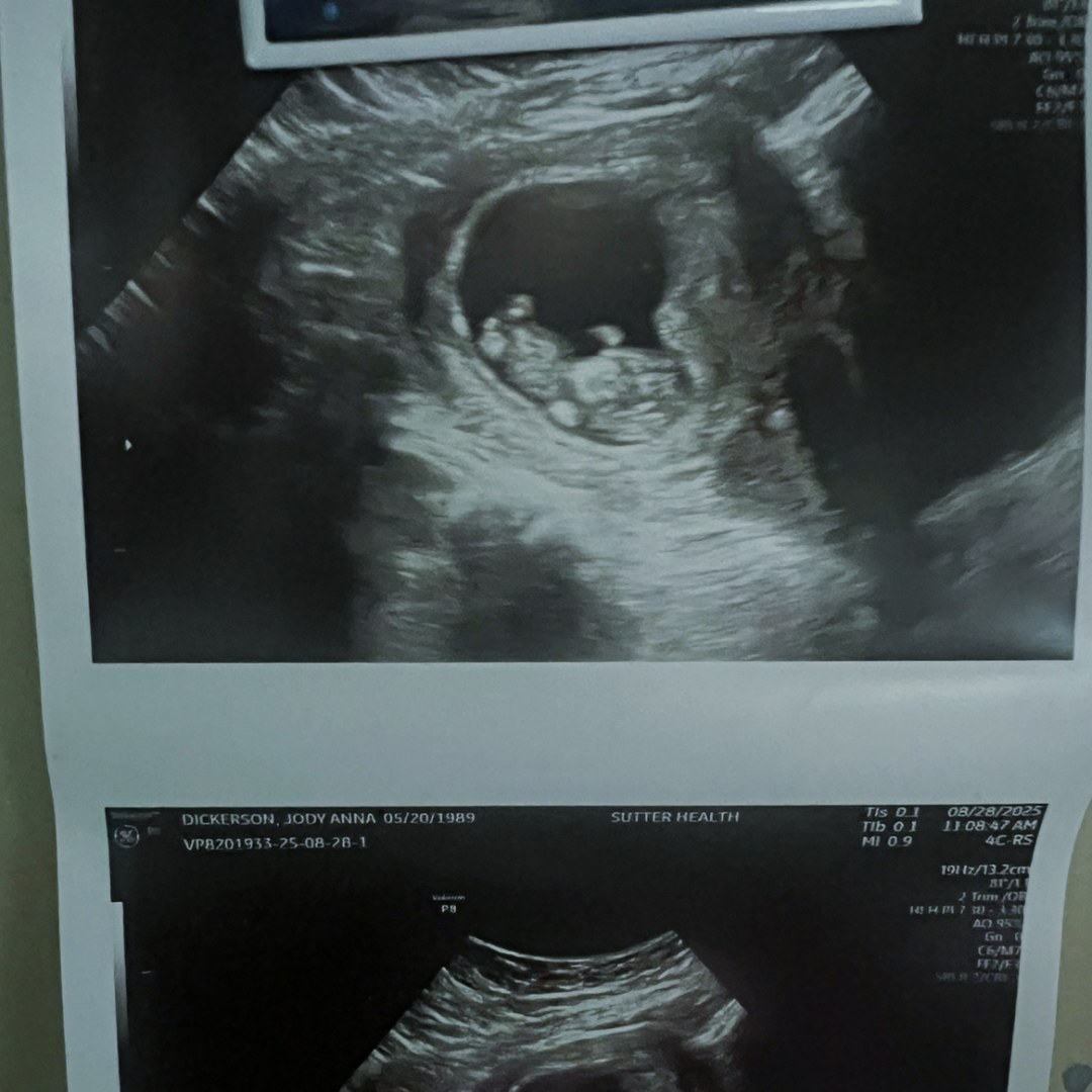 Photo shared by Jody for their Babylist baby registry.