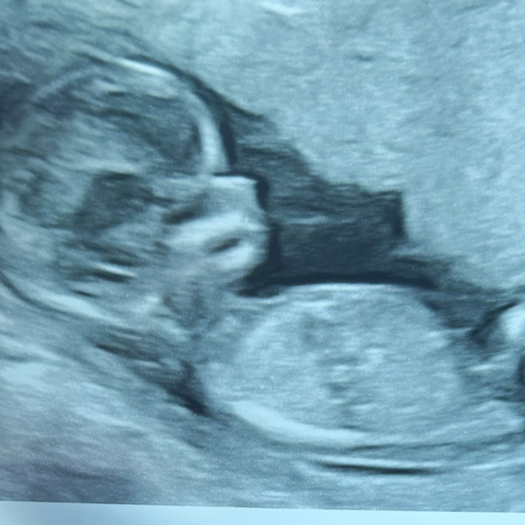 Photo shared by Christabelle for their Babylist baby registry.