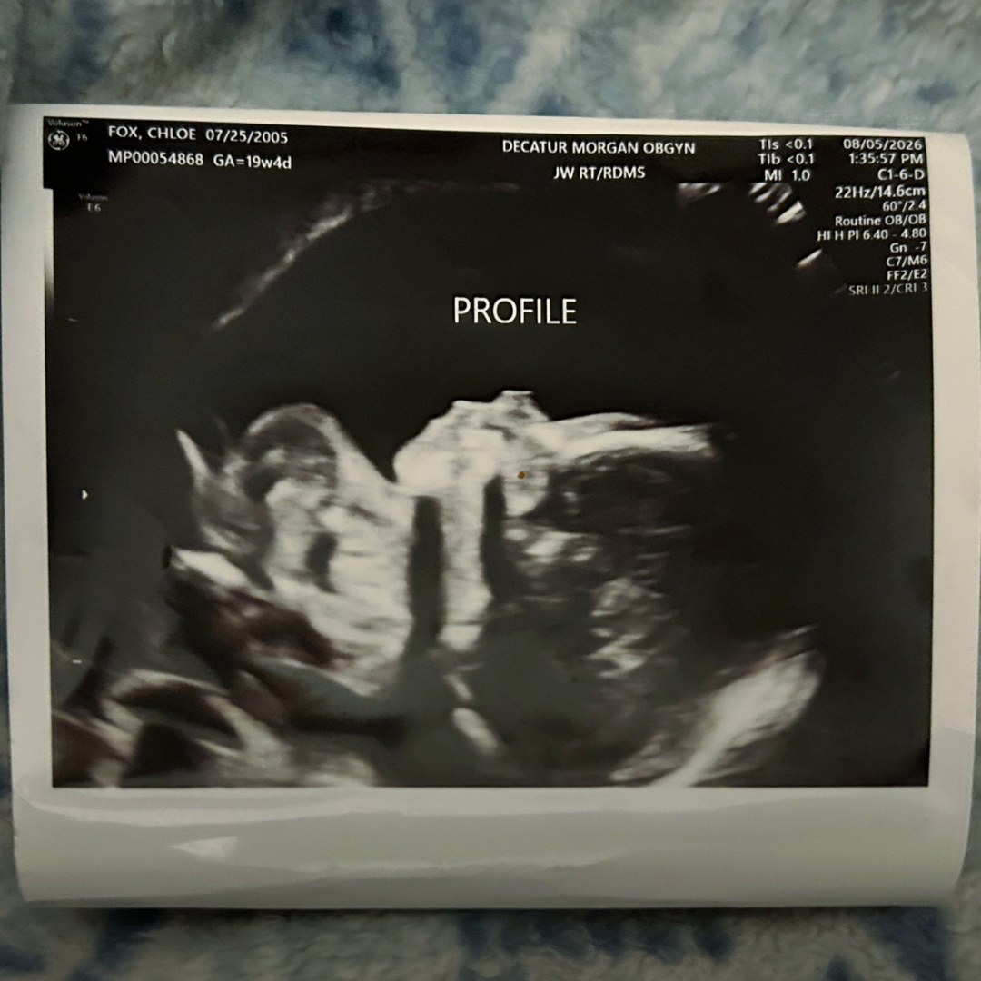 Photo shared by Chloe for their Babylist baby registry.