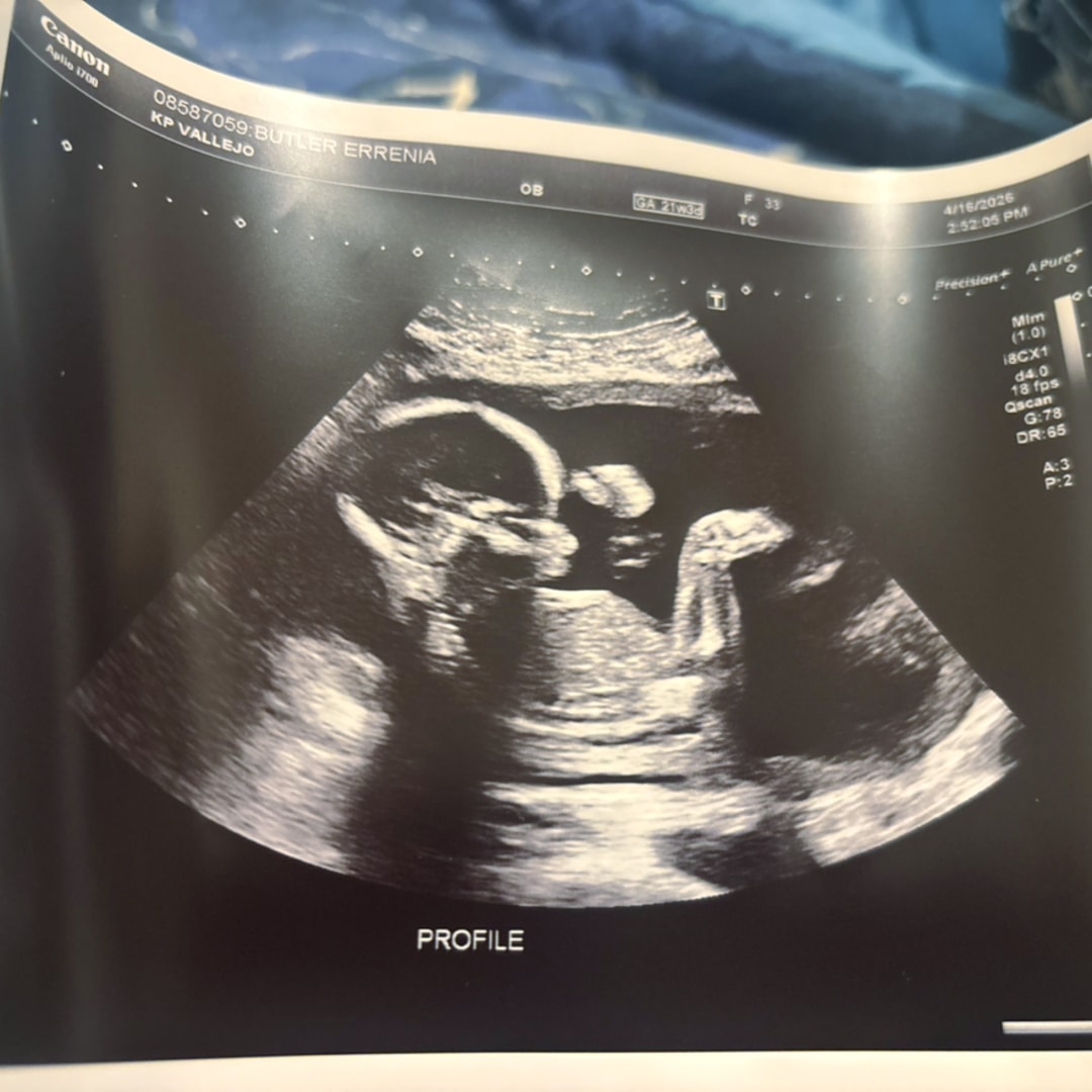 Photo shared by Errenia for their Babylist baby registry.