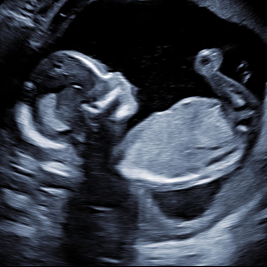 Photo shared by Jordan for their Babylist baby registry.