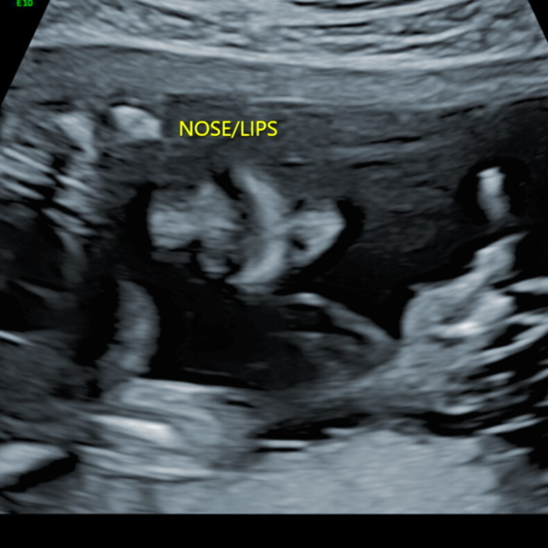 Photo shared by Olivia for their Babylist baby registry.