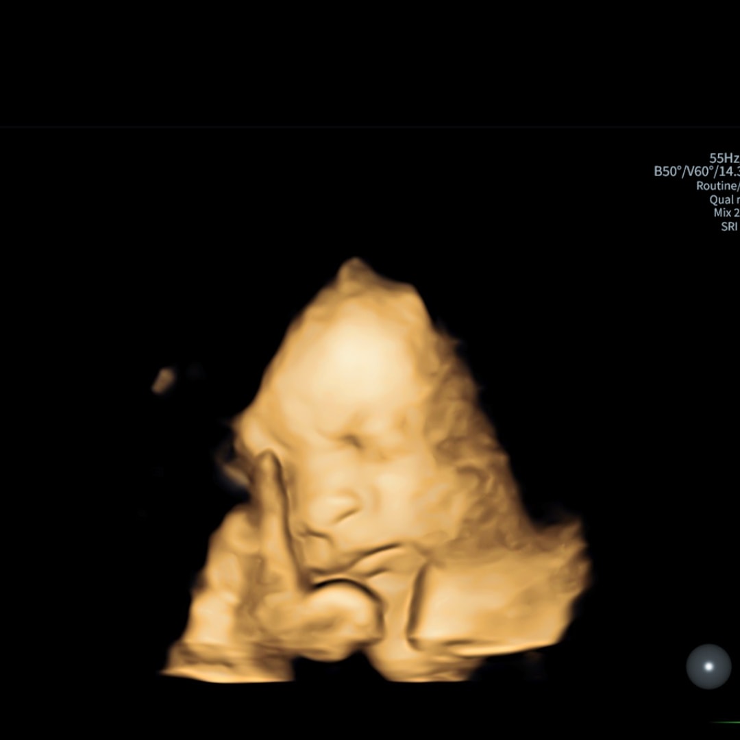 Photo shared by Allie for their Babylist baby registry.