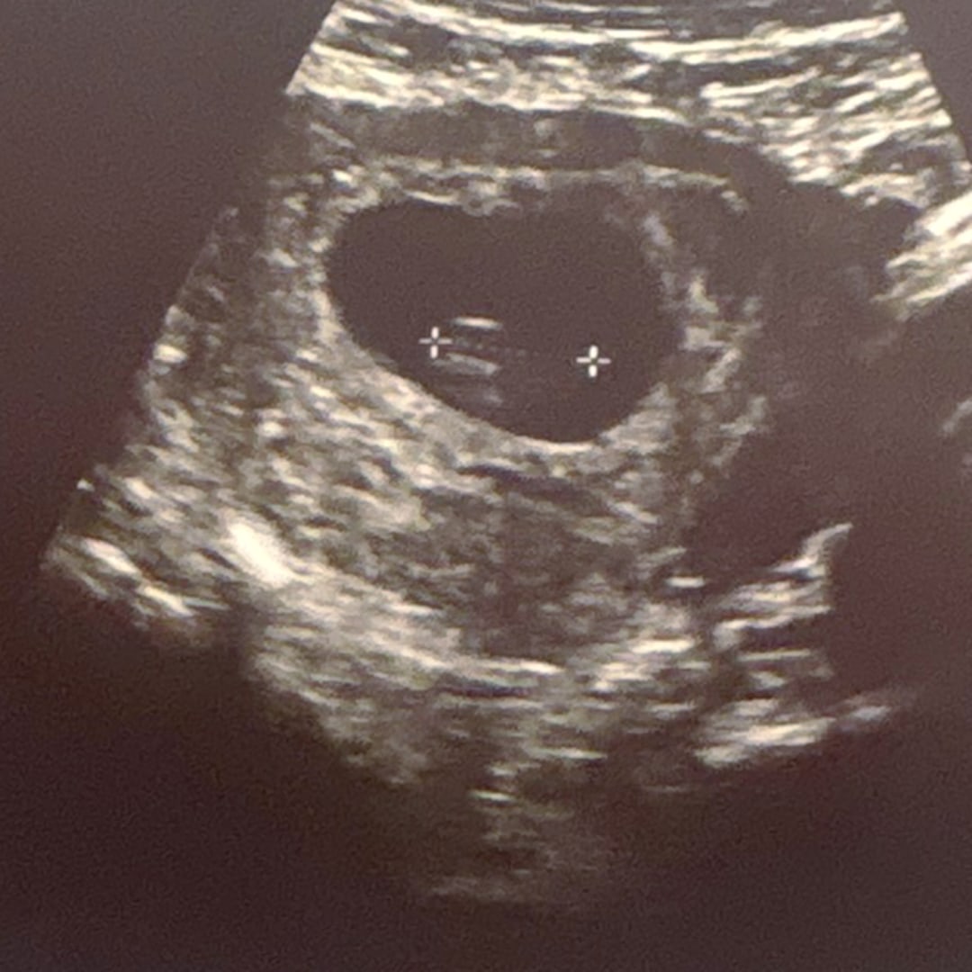 Photo shared by Kimberly for their Babylist baby registry.