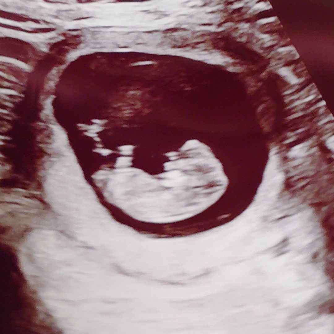 Photo shared by Victoria for their Babylist baby registry.