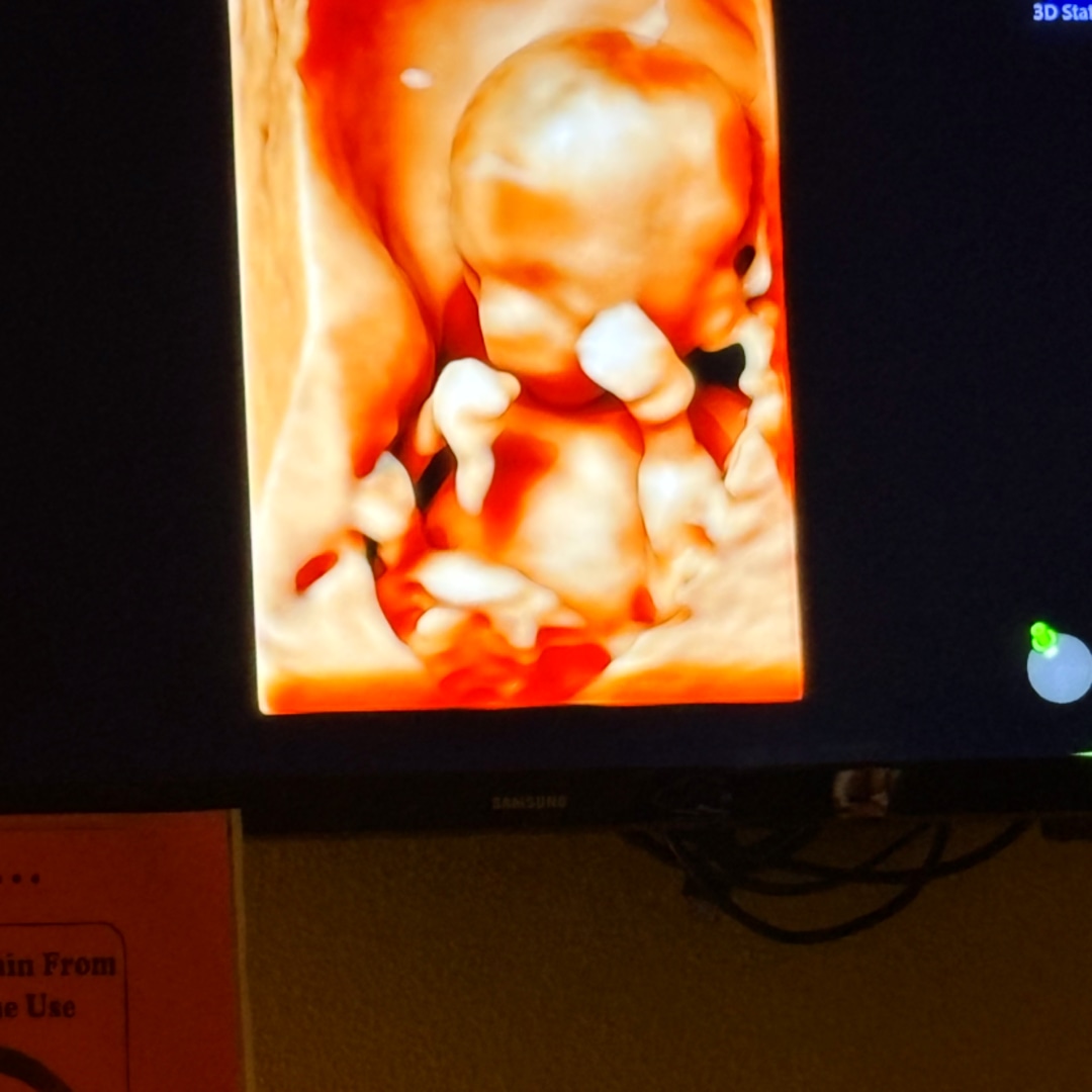 Photo shared by Aunya for their Babylist baby registry.