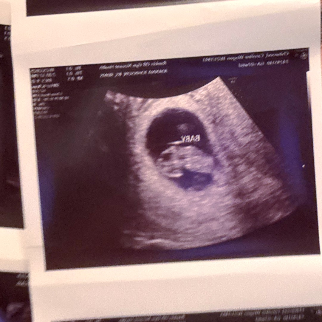 Photo shared by Caroline for their Babylist baby registry.
