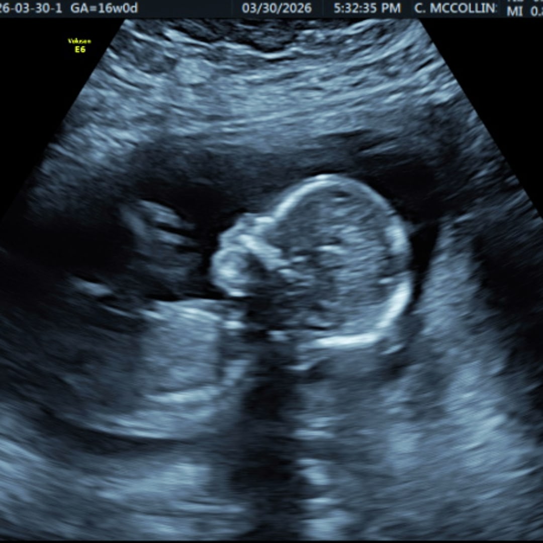 Photo shared by Lindsey for their Babylist baby registry.