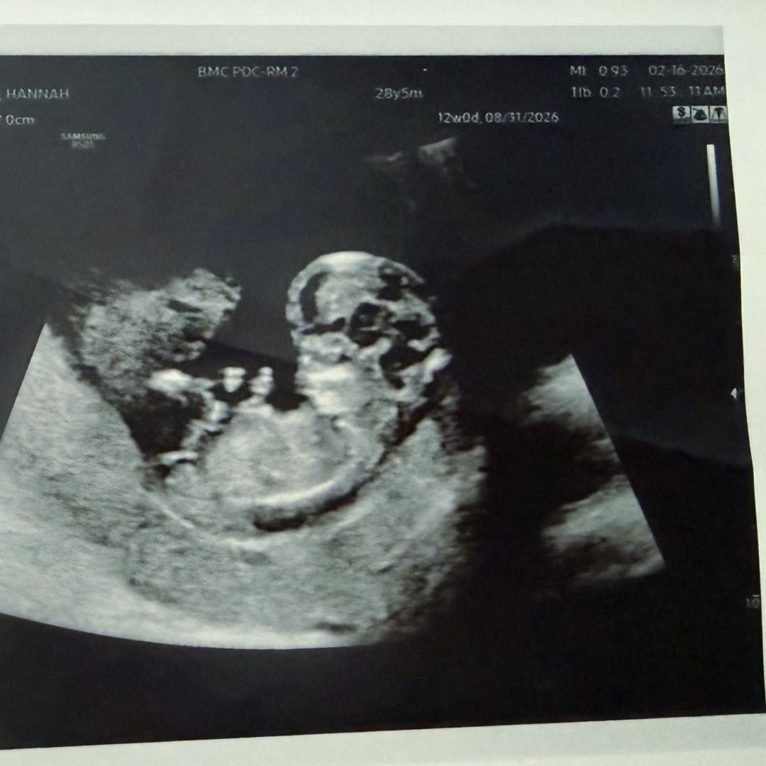 Photo shared by Hannah for their Babylist baby registry.