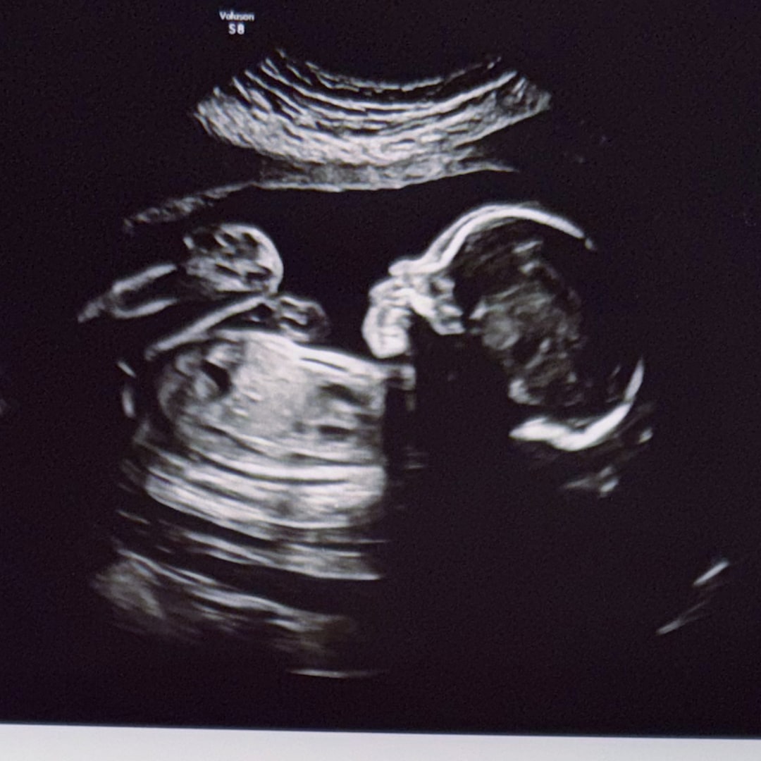 Photo shared by Kaydence for their Babylist baby registry.