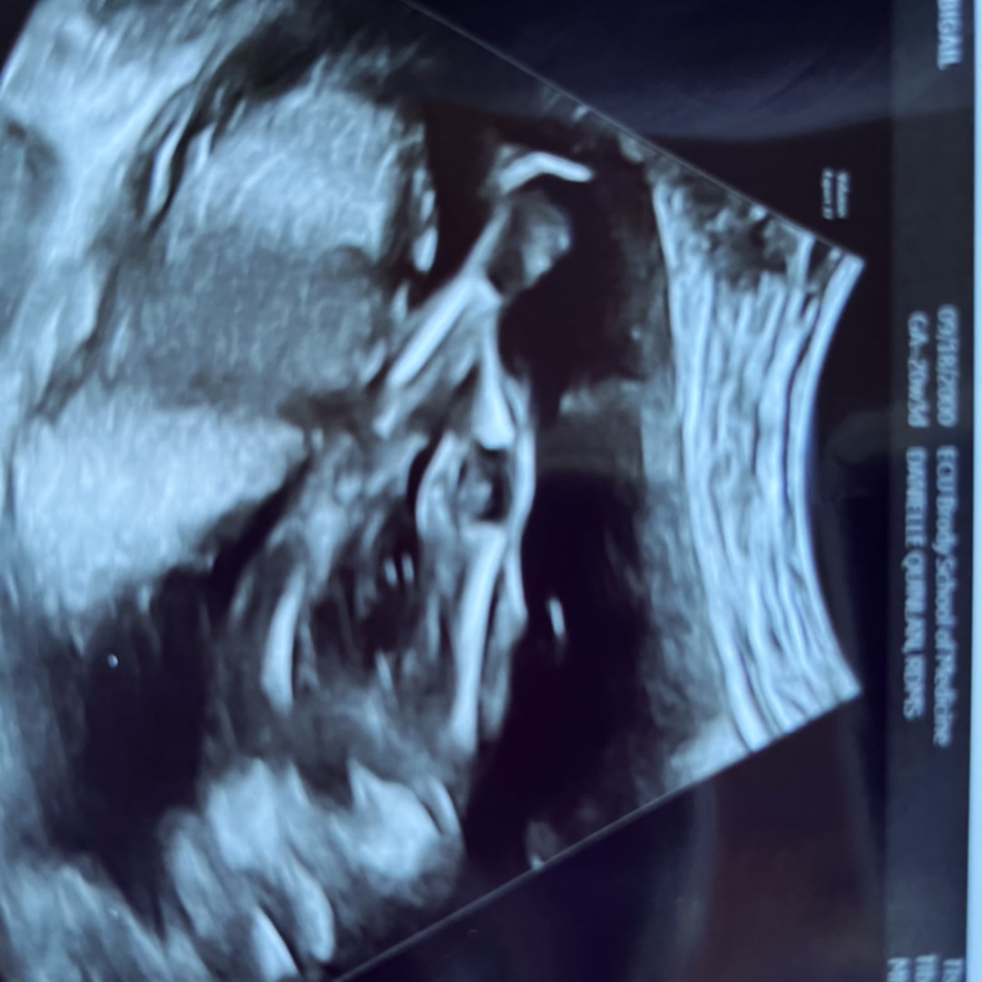 Photo shared by Abbigail for their Babylist baby registry.