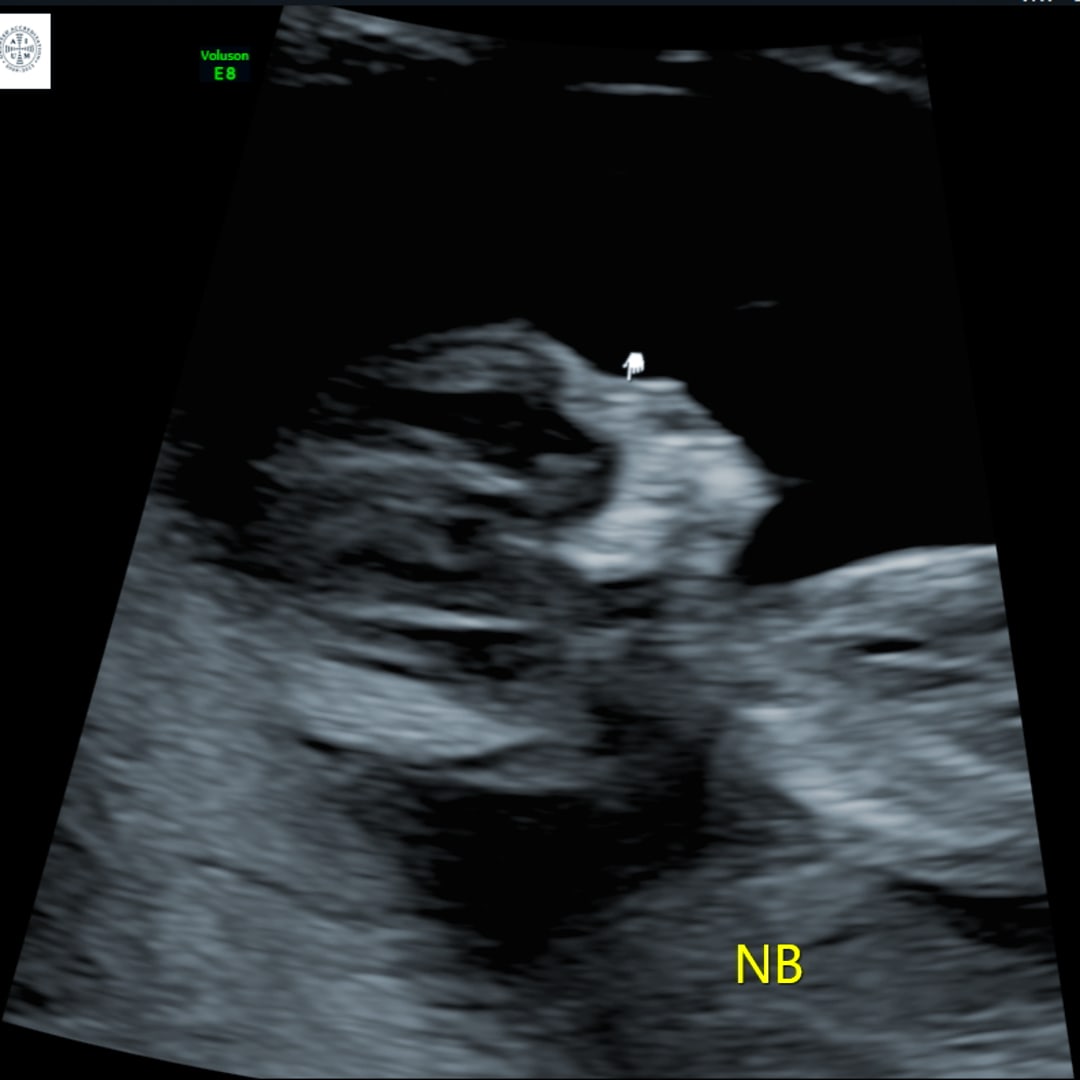 Photo shared by Janiya for their Babylist baby registry.