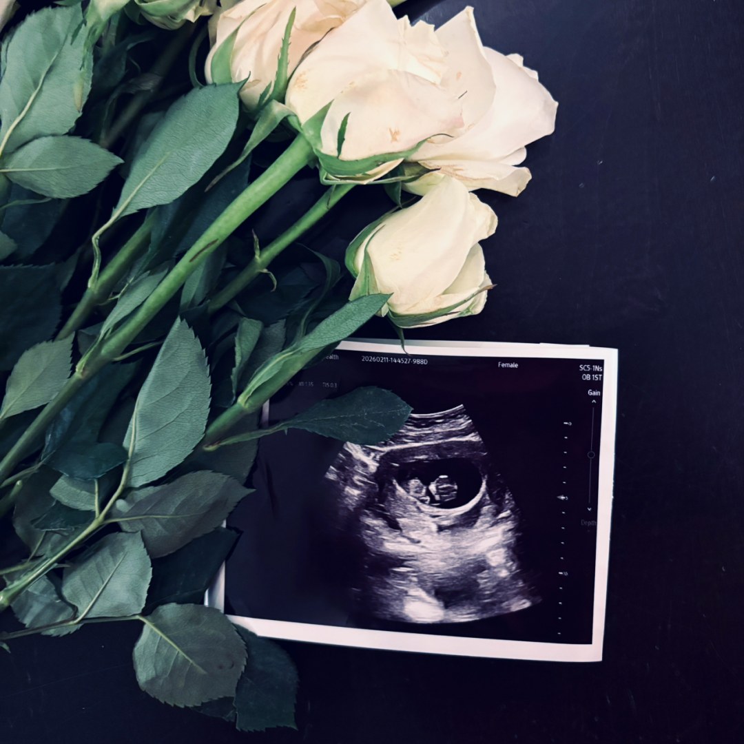 Photo shared by Kathryn for their Babylist baby registry.