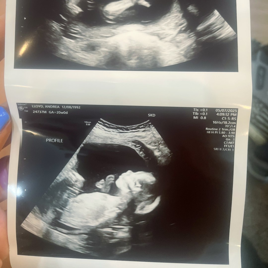 Photo shared by Andrea for their Babylist baby registry.