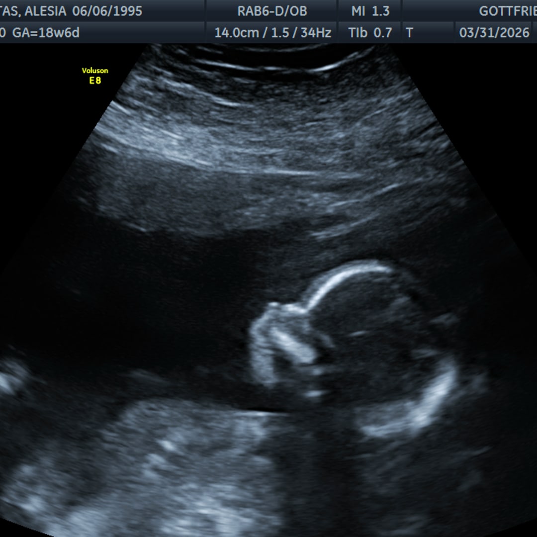 Photo shared by Alesia for their Babylist baby registry.