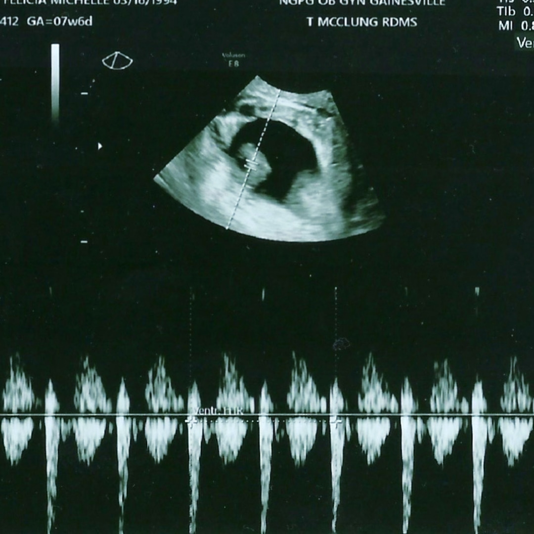 Photo shared by Felicia for their Babylist baby registry.
