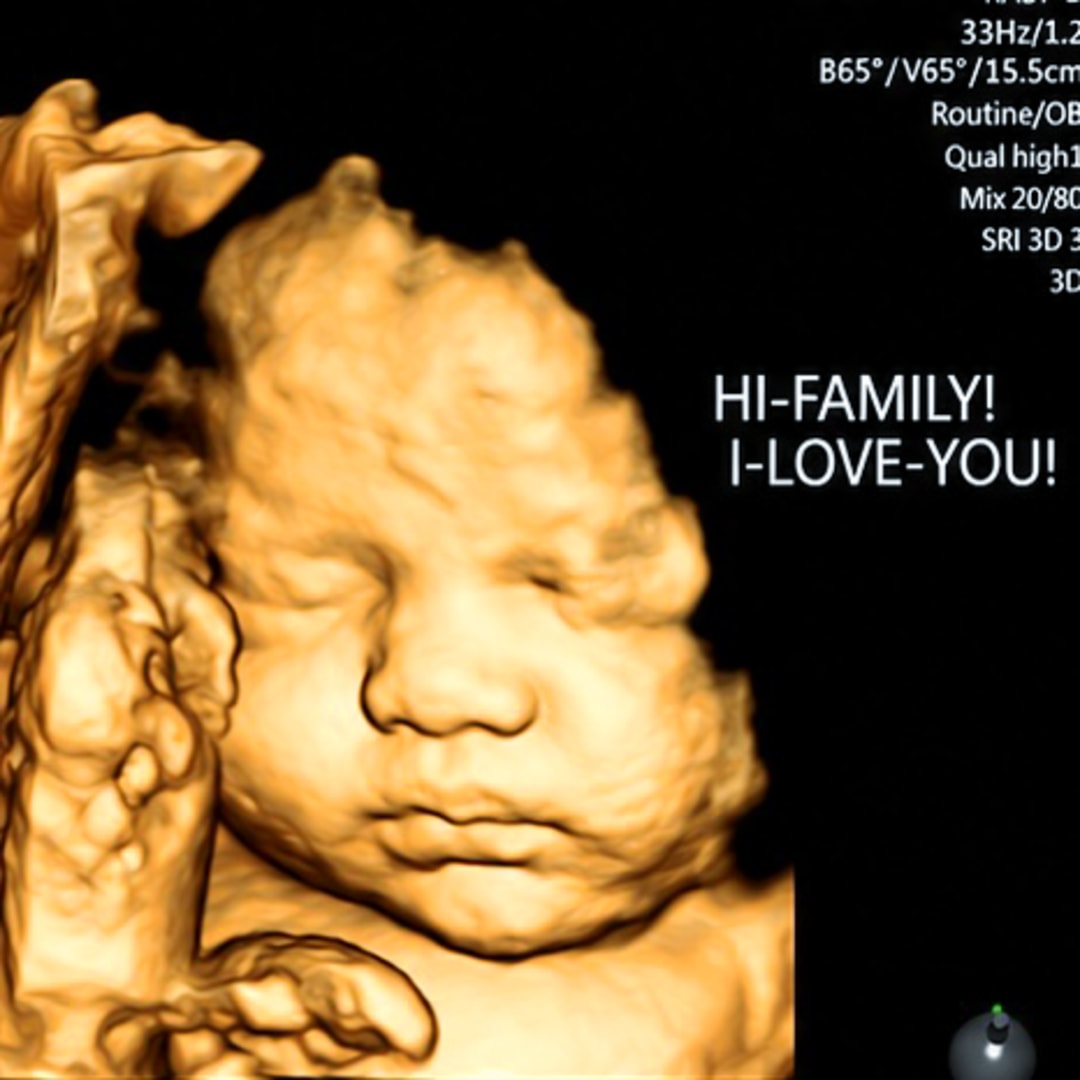 Photo shared by Yamilet for their Babylist baby registry.