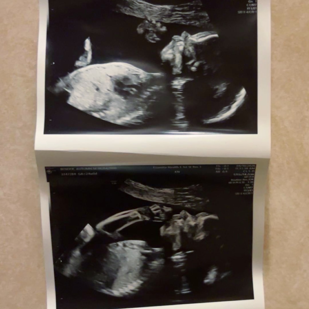 Photo shared by Autumn for their Babylist baby registry.