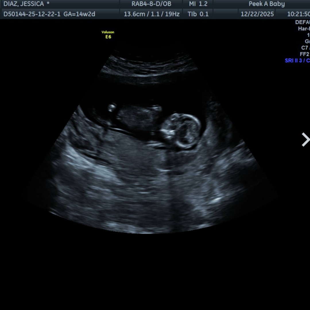 Photo shared by Jessica for their Babylist baby registry.