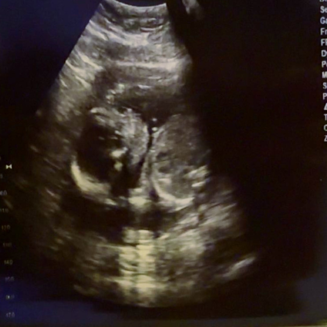 Photo shared by Jenna Grace for their Babylist baby registry.