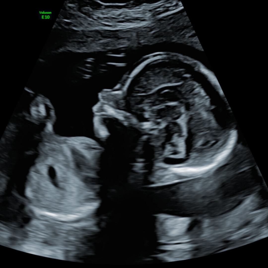 Photo shared by Mika for their Babylist baby registry.