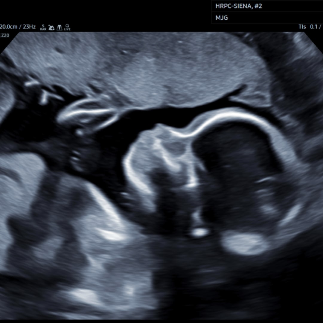 Photo shared by Evelyn for their Babylist baby registry.