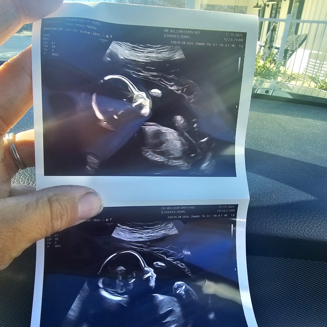 Photo shared by Nikita for their Babylist baby registry.